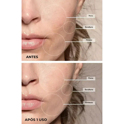 Luminesce™ - 7-in-1 LED Facial